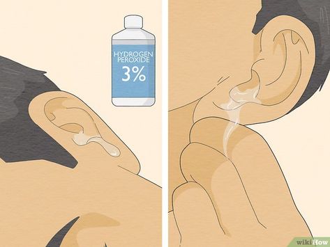 How to Remove Water from Ears: 12 Simple Tricks to Try How To Remove Water From Ear, Water Stuck In Ear, How To Clear Clogged Ears, How To Drain Fluid From Ears, How To Unclog Ears, Get Water Out Of Ear, How To Get Water Out Of Your Ear, Swimmers Ear Remedy Kids, Water In Ear Remedy