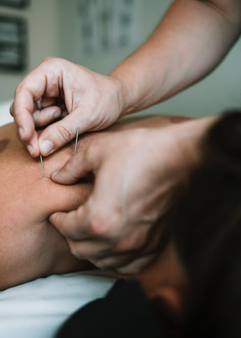 Dry Needling Therapy Physical Therapist, Physio Photography, Massage Branding, Needling Therapy, Dry Needling Therapy, Chiropractic Marketing, Myofunctional Therapy, Remedial Massage, Massage Therapy Business