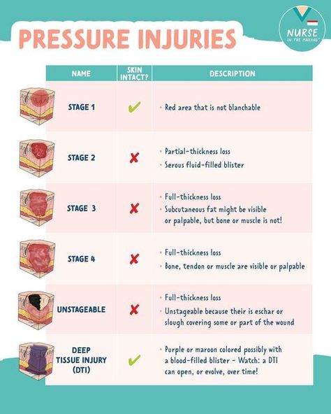 Pressure Injury Stages, Wound Assessment Nursing, Pressure Ulcers Nursing, Nurse In The Making Study Guides, Nursing Wound Care, Nursing Notes Organization, Nursing Graphics, Cna Notes, Nclex Lpn