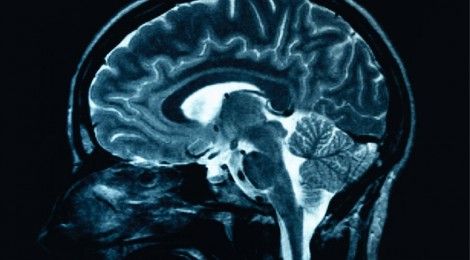 Psychological Trauma and the Brain: Interview with Kim Shilson Limbic System, Brain Scan, Brain Chemistry, Brain Damage, Human Brain, Health Articles, Alzheimers, Neuroscience, The Words