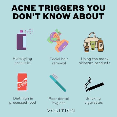 What Causes Acne, Treat Acne Naturally, Blind Pimple, Pimples Under The Skin, Bad Acne, Oily Skin Care Routine, Skin Advice, Prevent Pimples, Natural Acne Remedies