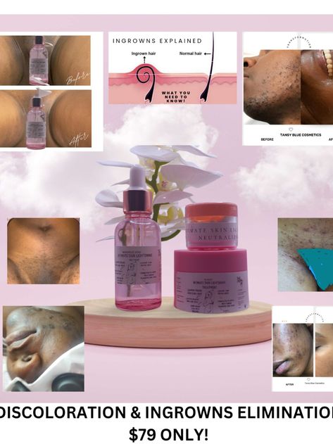 Intimate Areas Skin Lightening. Ingrown Hairs, Skin Lightening, Normal Hair, Ingrown Hair, Skin, Beauty, Quick Saves, Black