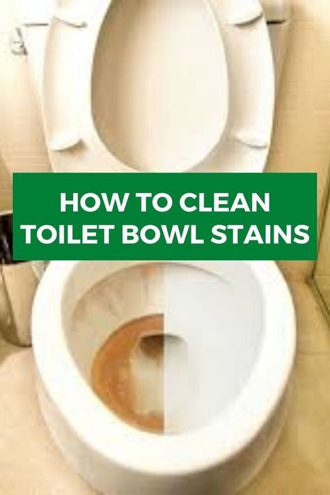 Cleaning Toilet Stains, Clean Toilet Bowl Stains, Toilet Bowl Stains, Toilet Cleaning Hacks, Toilet Stains, Clean Toilet, Clean Toilet Bowl, Shoe Lace Patterns Converse, Easy Cleaning Hacks