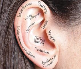 Communication Disorders, Deaf Awareness, Hearing Problems, Deaf Culture, Hearing Health, Ear Health, Home Beauty Tips, Hearing Loss, Hearing Aids