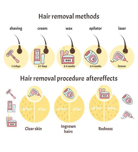 Natural Hair Removal Remedies, To Remove Facial Hair, Laser Hair Removal Cost, Leg Hair Removal, Waxing Tips, Best Laser Hair Removal, Laser Removal, Ipl Laser Hair Removal, Shaving Tips