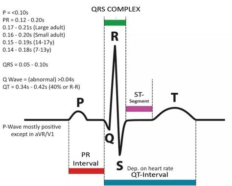 How to read a telemetry strip and values Telemetry Technician, Ns 125, Emt Study, Ekg Interpretation, Ecg Interpretation, Pr Interval, Medical Assistant Student, Nurse Study Notes, Basic Anatomy And Physiology