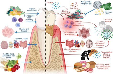 Frontiers | Periodontal Disease: The Good, The Bad, and The Unknown Immanuel Kant, Unhealthy Diet, Dental Cleaning, Periodontal Disease, Beneficial Bacteria, Oral Hygiene, The Unknown, Oral Health, Oral Care