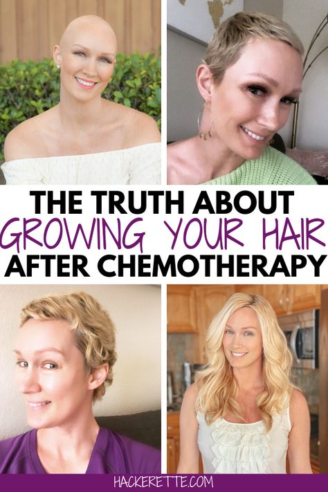 Chemo Short Hair Styles, Growing Hair After Chemo Style, Before Chemo Haircut, Short Hairstyles After Chemo, Chemo Dinner Ideas, Hairstyles After Chemo Hair Growth, Styling Hair After Chemo, Haircuts After Chemo, Chemo Pixie Haircut