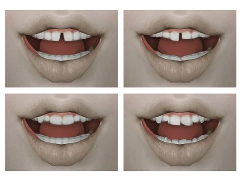 Sims4 Cc Teeth, Teeth Cc Sims 4, Sims 4 Cc Teeth, Sims 4 Teeth Cc, Ts4 Lookbook, Sims Design, Ts4 Mods, My Files, Sims 4 Cas Mods