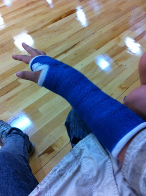 Another cast for another 3 weks😕 Broken Arm Cast Snapchat, Broken Arm Cast, Sicilian Defense, Arm Cast, Hospital Photos, Broken Arm, In The Hospital, The Hospital, Defense