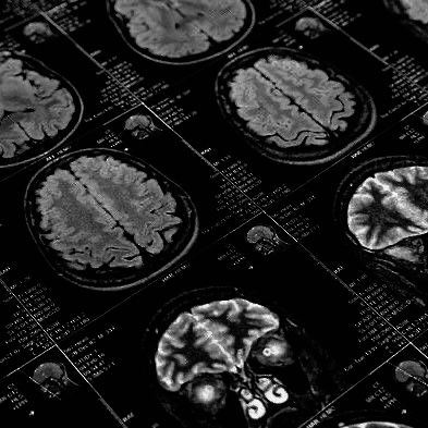 Black And White Science Aesthetic, Medical Experiment Aesthetic, Brain Black And White Aesthetic, Pheromones Aesthetic, Dark Biology Aesthetic, Electroshock Therapy Aesthetic, Neurotechnology Aesthetic, Medical Horror Aesthetic, Brain Scan Aesthetic