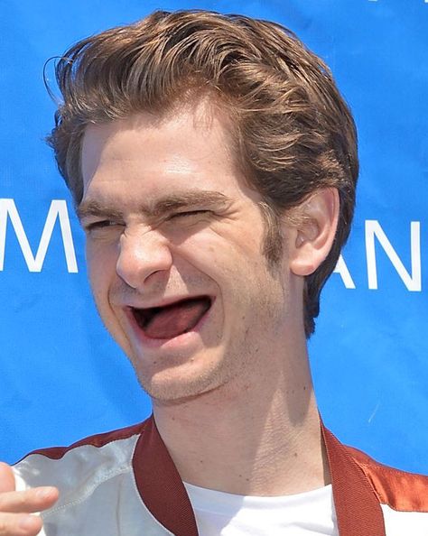 Andrew Garfield | 16 Actors With No Teeth @Victoria Brown Antonello Dental Bridge Cost, Teeth Humor, Dental Quotes, Funny Photos Ideas, Dental Tourism, Dental Bridge, Best Teeth Whitening, Dental Procedures, Natural Teeth