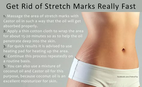 How To Get Rid Of Strech Marks On Waist, How To Get Rid Of Stench Marks, How To Get Rid Of Strech Marks On Breast, How To Get Rid Of Strech Marks On Hips, How To Get Rid Of Strech Marks On Thighs, How To Get Rid Of Stretchmarks Fast, How To Remove Strechmark, Dryskin Skincare, Strech Marks