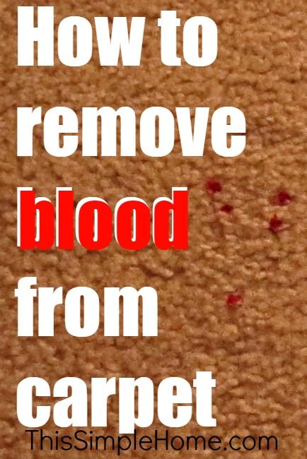 How to remove blood stains from carpet Blood Out Of Carpet, Remove Blood Stains, Clean Car Carpet, Carpet Cleaning Business, Deep Carpet Cleaning, Cleaning Stuff, Diy Carpet Cleaner, Carpet Cleaning Solution, Carpet Cleaning Machines