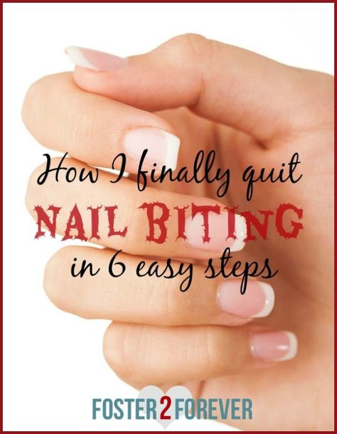 I didn't realize that kicking a lifelong bad habit could really happen! Check out these nail biting remedies! Nail Ideas For Bitten Nails, How To Stop Nail Biting Habit, Stop Biting Nails Remedies, How To Not Bite Your Nails, How To Stop Nail Biting, How To Stop Biting Nails, Nail Biting Remedies, Nail Biting Habit, Biting Nails