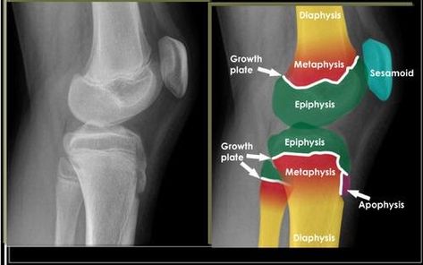 If you are looking to increase your height, it is essential to pay close attention to the status of your growth plates. These plates provide crucial information about whether you can still grow taller and if so, how much time is left before your height growth comes to a halt. Additionally, they can help you […] What To Eat To Grow Taller, Foods That Help You Grow Taller, Heights Increase Food, Height Exercise Grow Taller, Hight Growth Tips Grow Taller, Epiphyseal Plate, Increase Your Height, Height Growth, Grow Taller