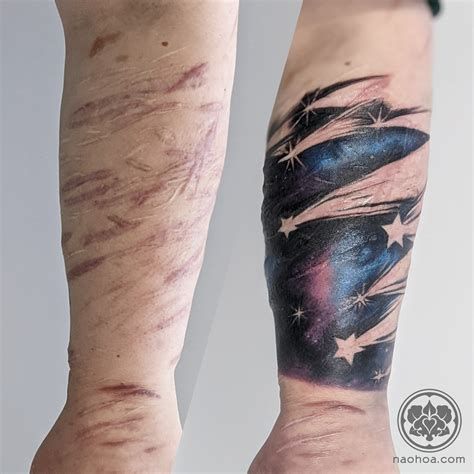 Tattoo Over Scar at Marielewis -  #Marielewis #Scar #Tattoo Scarification Tattoos, Scar Coverup Tattoo, Scar Ideas, Tattoo Scar, Blue Homecoming Nails, Tattoo Over Scar, Homecoming Nails Almond, Scar Cover Up, Omerta Tattoo Design