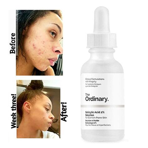 Glow Up: Affordable Skincare Must-Haves from The Ordinary - Dr Adil The Ordinary Squalane, The Ordinary Salicylic Acid, The Ordinary Azelaic Acid, Acne Routine, Ordinary Niacinamide, Affordable Skincare, The Ordinary Hyaluronic Acid, Vitamin And Mineral, Exfoliating Toner