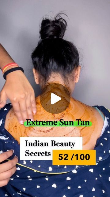 Sun Burned Face, How To Remove Sun Tan From Face, Sun Tan Removal Remedies, Tan Removal Remedies, Remove Tan From Face, Indian Beauty Secrets, Home Remedies For Face, Skin Tan Removal, Sun Tan Removal