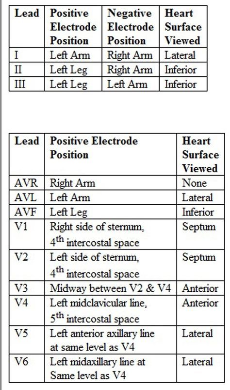 12 Lead Ekg Placement, Ecg Placement, Ekg Placement, Lead Placement, Ekg Technician, Emt Study, Cardiology Nursing, Ekg Interpretation, Ecg Interpretation