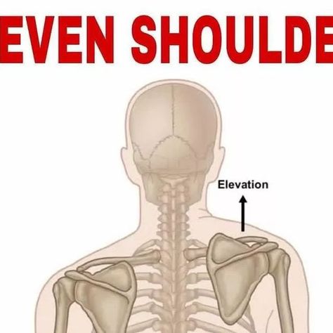 Back Pain Relief Tricks on Instagram: "💥uneven shoulders💥 Follow @backpainrelieftricks 👈 📚 Uneven shoulders occur when one shoulder is higher than the other. This can be a slight or significant difference and may be due to several causes. . . ✅ Uneven shoulders can also happen when you have structural issues or muscular skeletal imbalances in the body. This may include legs that vary in length or scoliosis. . . 💯 Several factors can lead to uneven shoulders like * carrying a heavy bag * poo Uneven Shoulders Exercise, Uneven Shoulders, Uneven Hips, Chest Congestion, Sedentary Lifestyle, Shoulder Injuries, Tennis Elbow, Simple Exercises, Shoulder Stretch