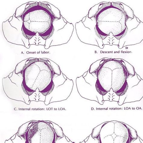 Student Midwife Studygram on Instagram: "👶🏼 This is such a good diagram showing the mechanism of labour 👶🏼 #mechanism #labour #studentmidwife #studygram✨ #studynotesfordays #studentmidwife #studynotesfordays #childbirth #pelvis @cambridgeuniversitypress" Mechanism Of Labour, Pelvis Anatomy, Midwife Birth, Yoongi Boyfriend, Med Notes, Certified Nurse Midwife, Midwifery Student, Doula Care, Medical Study