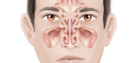 What is sinus? Sinuses are cavities usually filled with air located around forehead, eyes and cheeks. Read Causes and 5 quick steps to treat sinus in no time! Ear Congestion, Paranasal Sinuses, Sinus Cavities, Chronic Sinusitis, Nasal Septum, Sinus Pain, Loss Of Balance, Upper Respiratory Infection, Head Pain