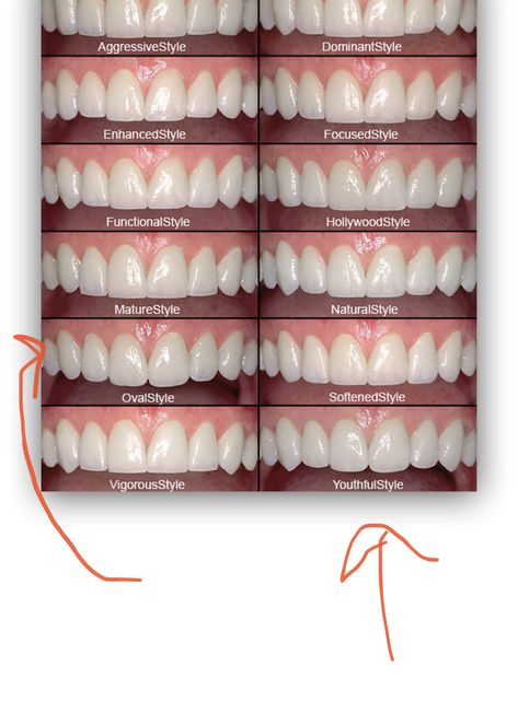 Teeth Shape, Dental Implants, Design