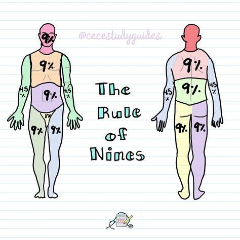 The rule of 9s is a quick way to estimate the percentage of a body burned in an adult. Each major body part is assigned a percentage that is a multiple of 9: 🔸Head and neck: 9% 🔸Each arm: 9% 🔸Each leg: 18% 🔸Front torso (chest and abdomen): 18% 🔸Back torso: 18% 🔸Groin area (perineum): 1% How to use it: ➡️ Identify the burned areas: Determine which body parts have been burned. ➡️Add the percentages: Add up the percentages of the burned areas to get an estimate of the total body surface... Rule Of Nines, Nurse Hacks, Simple Nursing, Pt School, Nursing Flashcards, Medical Terminology Study, Nurse Skills, Nurse Notes, Nursing Study Tips