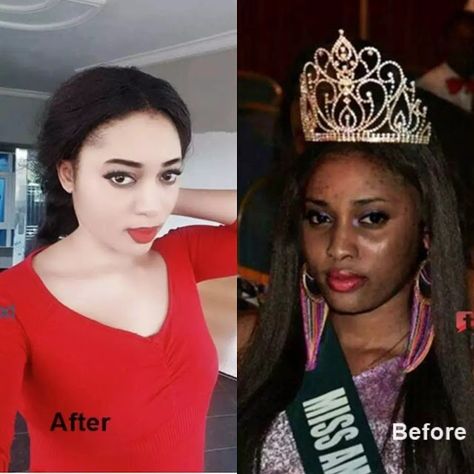 - Those who lighten their skin often admit to doing so. But model Beauty Istifanus has continually denied that she bleached   - Despite ... Bleach Skin, Bleaching Skin, Bleaching Your Skin, Massage Routine, Lighten Skin Tone, Skin Lightening Cream, Diy Skin Care Recipes, Lightening Creams, Beauty Tips For Glowing Skin