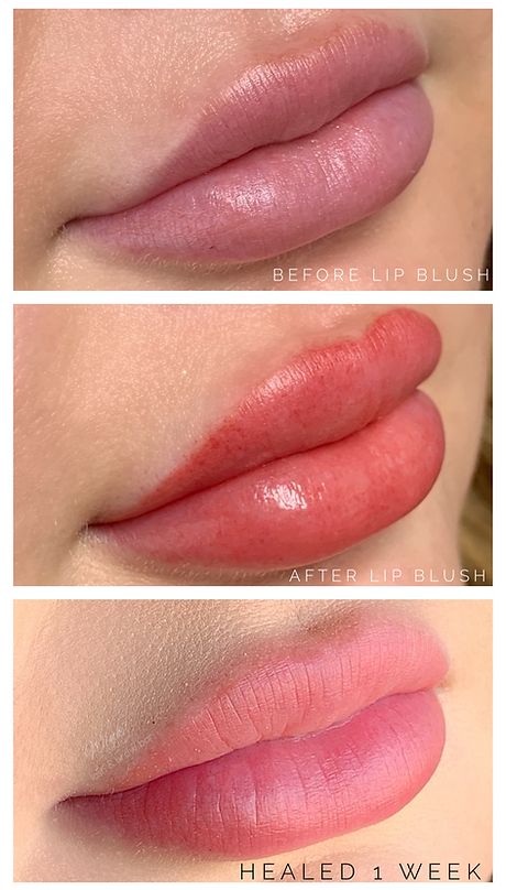 LIP BLUSHING FAQ | wink-iboutique Lip Blushing Tattoo Before And After, Lip Blushing, Fever Blister, Lip Blush, Permanent Cosmetics, Small Lips, Cold Sore, Scar Tissue, Lip Scrub