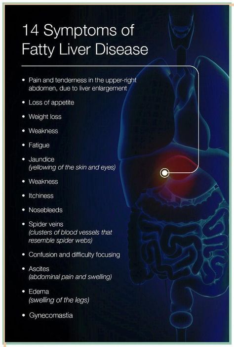 CHECK YOUR BODY: Warning Signs That You Have a Fatty Liver Ways and How to Cleanse It – Koperacija The liver is an important organ located in the upper quadrant of the abdomen. It is the largest organ... Quadrants Of The Abdomen, Liver Cleanse Juice, Sinus Congestion Relief, Lung Detox, Amino Acid Supplements, Liver Diet, Liver Detox, Healthy Liver, The Liver