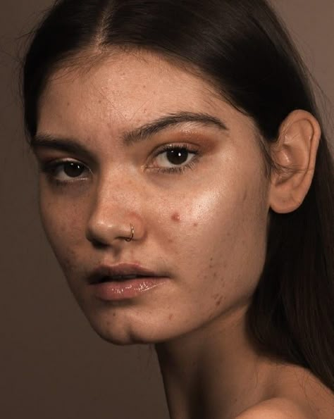 Peter Devito, Girl With Acne, Acne Positivity, Skin Positivity, Different Skin Types, Real Skin, People To Draw, Raw Photo, Portrait References