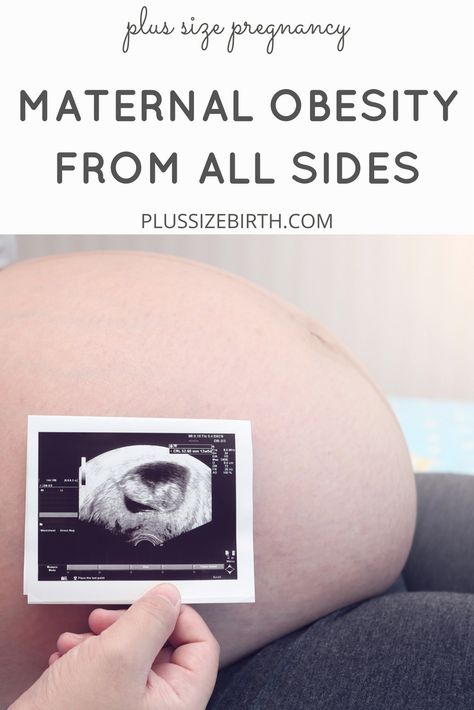 Maternal Obesity from All Sides: An Interview with Kimmelin Hull | Plus Size Pregnancy | Plus Size and Pregnant | Fat and Pregnant Pregnancy Plus Size, Obese Pregnancy, Plus Size Peplum Dress, Twins Pregnancy, Plus Size Jumpers, Baby Bump Photos, Plus Size Tips, Pregnancy Body, Bump Photos