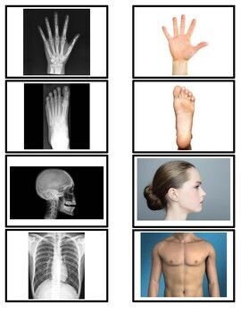 A fun and educational game for kids to learn about the human body. Match the x-rays to the body parts and learn their Preschool Body Theme, Human Body Projects, Human Body Activities, Montessori Science, Community Helpers Theme, Forest School Activities, All About Me Preschool, X Rays, Educational Games For Kids