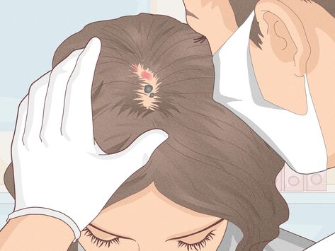 A guide to dealing with scalp folliculitis, hives, cysts, & more Bumps on your scalp can be stressful and irritating. Luckily, most of these pesky bumps are easy to treat, once you figure out what's causing them. Common causes include... Scalp Psorasischic Remedies, Scalp Sores, Bump On Head, Scalp Bumps, Infected Hair Follicle, Pimples On Scalp, Itchy Scalp Remedy, Blood Blister, Ear Wax Removal Video