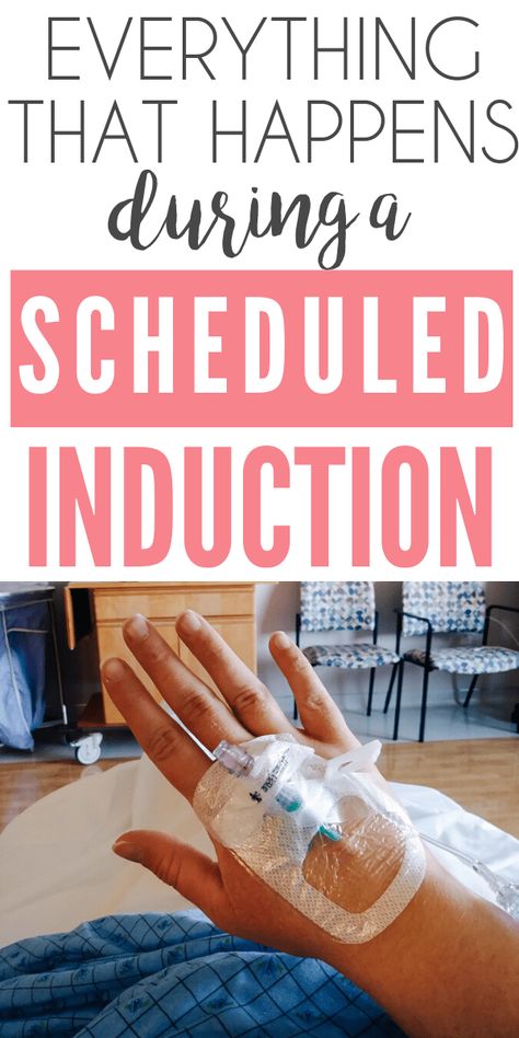 Here's everything that happens during a scheduled induction labor and how to prepare for it! Natural Induction Methods, Labor Preparation, Natural Ways To Induce Labor, Membrane Sweep, Ways To Induce Labor, Natural Labour Induction, Natural Induction, Labor Induction, Induction Labor