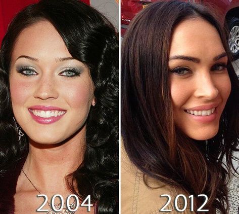 Megan Fox Before After, Lip Infection, Fox Nose, Megan Denise Fox, Celebrities Then And Now, Celebrities Before And After, Perfect Summer Outfit, Makeup Transformation, Nose Job