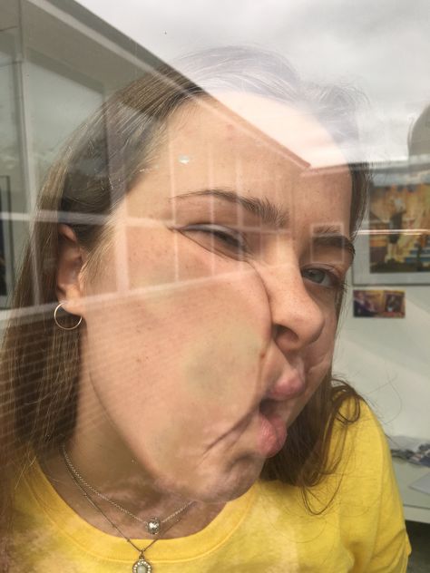 Face Squished Against Window, Face Pressed Against Glass Photography, Face Pressed Against Glass Drawing, Face Pressed Against Window, Face Against Window, Art Refrences Photography, Squished Face, Distortion Photography, Lemon Face Mask