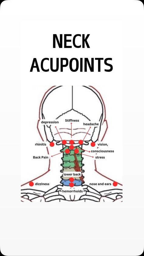 Neck Pressure Points Massage Therapy, Acupressure Points For Headache, Sinus Massage, Tapping Points, Reflexology Pressure Points, Severe Neck Pain, Meridian Acupuncture, Chiropractic Assistant, Acupuncture Points Chart