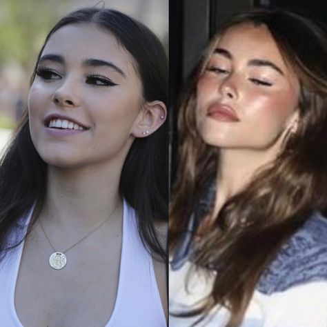 Madison Beer Before And After Surgery, Madison Beer Plastic Surgery, Lip Filler Before And After, Madison Bear, Face Plastic Surgery, 2024 Manifesting, Ugly Photos, Face Structure, Prom Eye Makeup