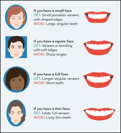 Suiting your face shape with tailored #teeth. Different Teeth Shapes, Teeth Shape Perfect, Veneers Before And After Small Teeth, Beautiful Teeth Shape, Teeth Shaping, Veneer Teeth, Dental Animation, Medical Items, Veneers Teeth