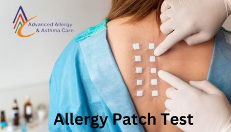 Allergy Patch Test Skin Allergy, Peanut Allergy, Allergy Asthma, Skin Patches, Allergy Testing, Skin Redness, Skin Allergies, Allergic Reaction, Sciatica