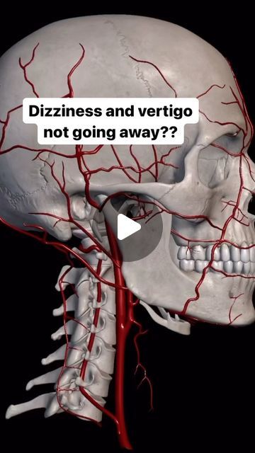 Natural Vertigo Remedies, How To Stop Dizziness, Vertigo Causes, Dizziness Causes, Cervical Disc, Cervical Spondylosis, Cervical Spine, A Doctor, Blood Flow