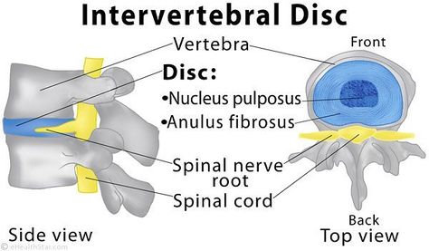 With #stemcells to new intervertebral discs http://bit.ly/2h2Lhqr Cervical Disc, Intervertebral Disc, Spinal Nerve, Physiotherapy Clinic, Pinched Nerve, Improve Nutrition, Inflammation Causes, Reflexology Massage, Leg Pain