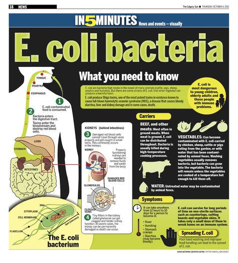 What you need to know about E.coli bacteria Food Safety Infographic, Food Microbiology, E Coli Bacteria, Food Product Development, Food Safety Posters, Food Safety And Sanitation, Food Safety Training, Culinary Lessons, Food Safety Tips