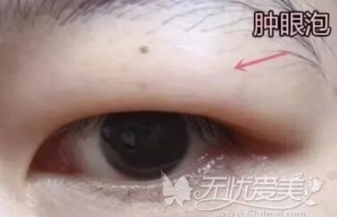 The ultimate guide to eyelid tape, including how to wear it on different types of eyes – Daily Vanity Singapore Types Of Eyelids, Saggy Eyelids, Different Types Of Eyes, Hooded Eyelids, Eye Tape, Droopy Eyes, Double Eyelid Tape, Eyelid Tape, Double Eyelid