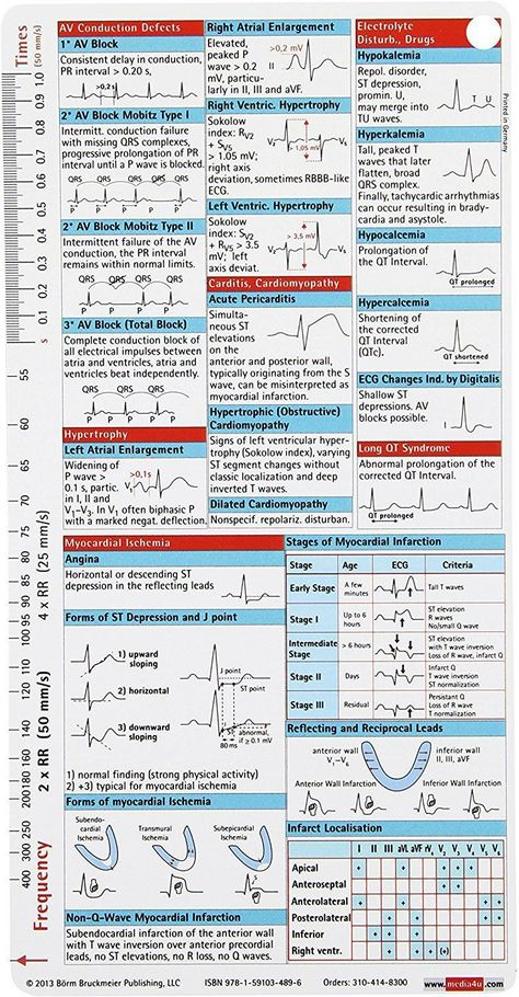 Cardiology Nursing, Medicine Notes, Nursing Mnemonics, Medical Student Study, Cardiac Nursing, Nursing School Survival, Critical Care Nursing, Nursing School Studying, Medicine Student