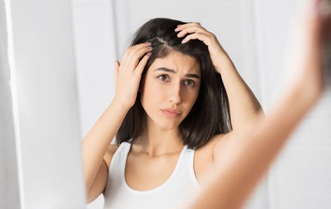 What Causes Dandruff, How To Treat Dandruff, Hair Falling, Growth Hair, Hair Issues, Anti Dandruff Shampoo, Hair Problems, Oily Hair, Dry Scalp