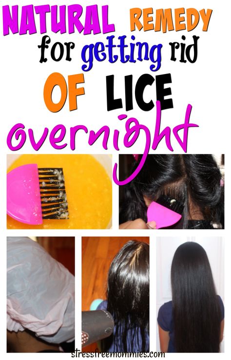 Does your child have head lice and you don't know how to get rid of it? this article will show you step by step how to get rid of head lice the natural way. Find out how to get rid of lice overnight, it actually works! How To Treat Lice, Lice Remedies, Hair Lice, Cooking With Turmeric, Lice Removal, Head Louse, Natural Healing Remedies, Diy Remedies, Tooth Brush